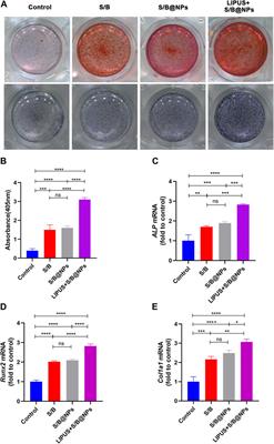 LIPUS-S/B@NPs regulates the release of SDF-1 and BMP-2 to promote stem cell recruitment-osteogenesis for periodontal bone regeneration